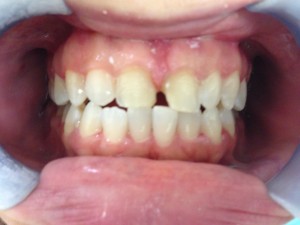 case-1-before