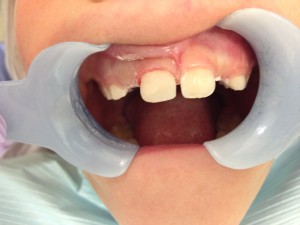 case-1-after