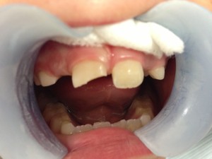 case-1-before