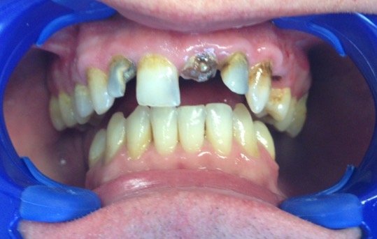 case-2-before